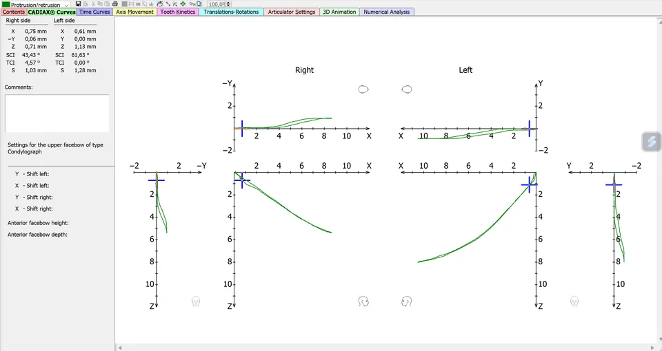 CADIAX protrusion recording