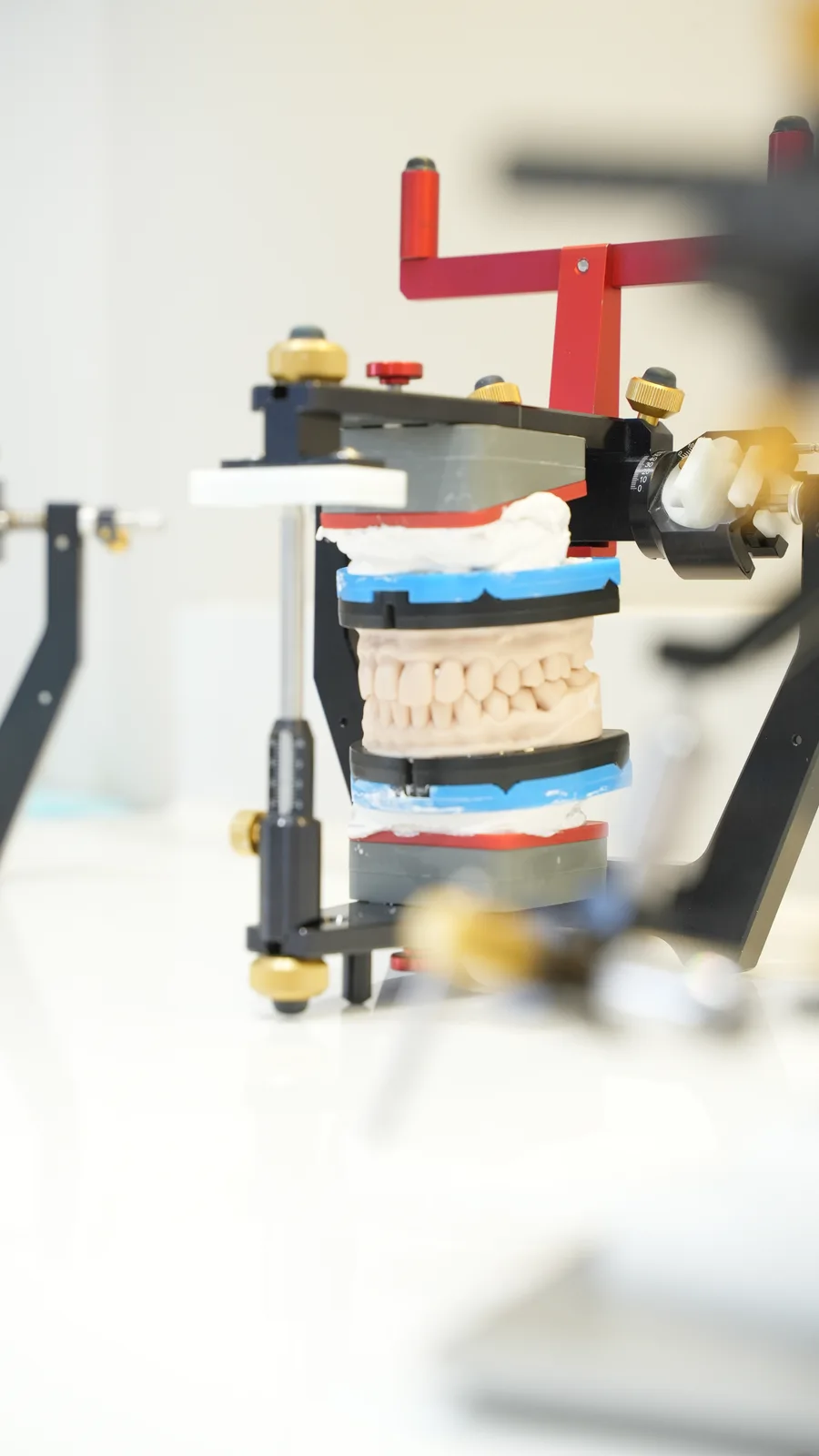 Dental models mounted in an articulator
