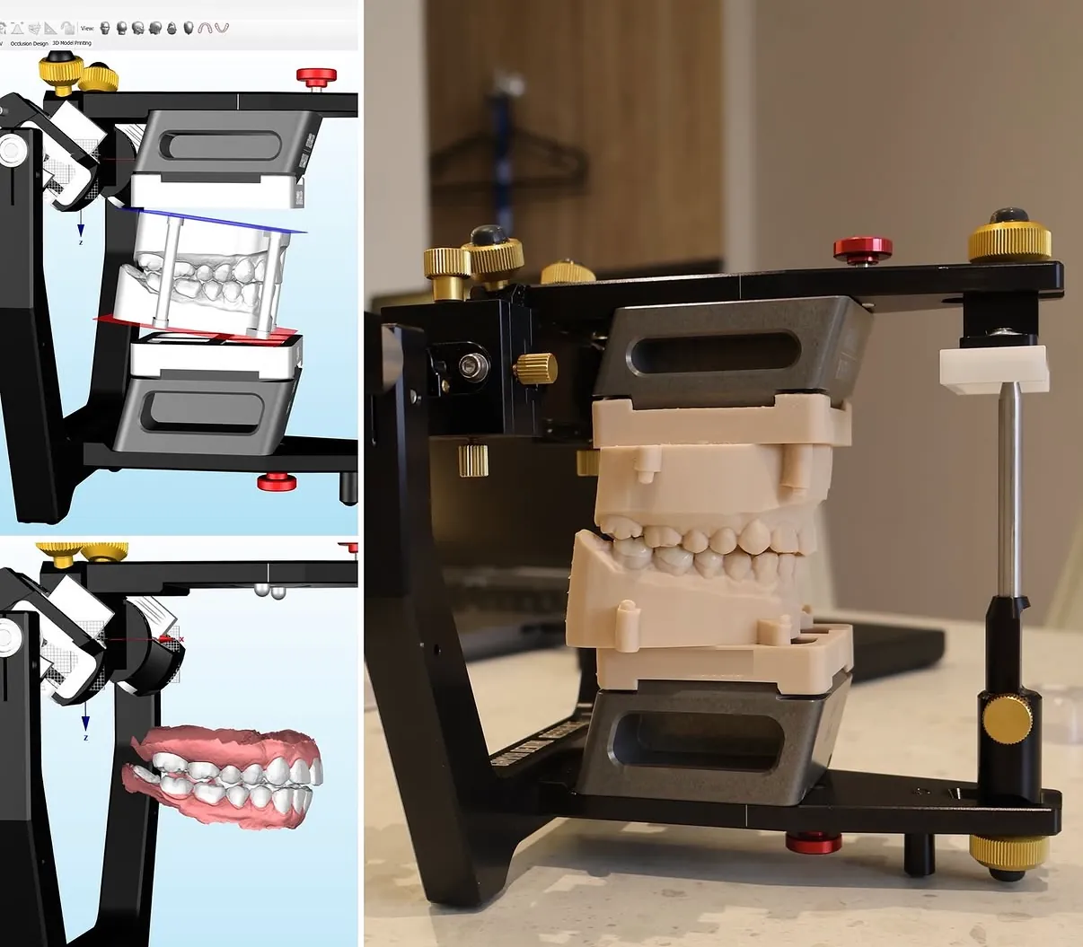 Digital models in a virtual articulator and physical models mounted in an articulator